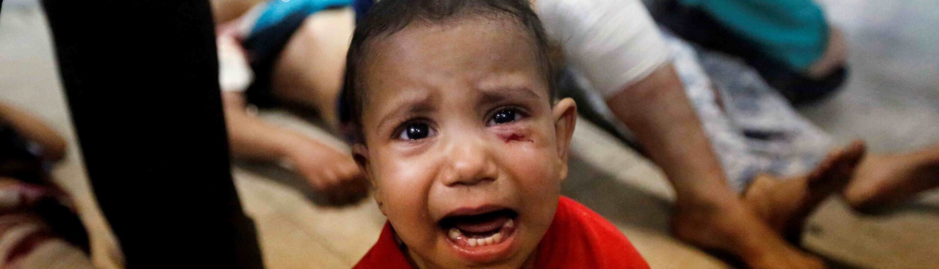 Σαλάχ Μούσα: “Δεν βασανίζει τις συνειδήσεις ότι 2.000 παιδιά ακρωτηριάστηκαν χωρίς αναισθητικό”;